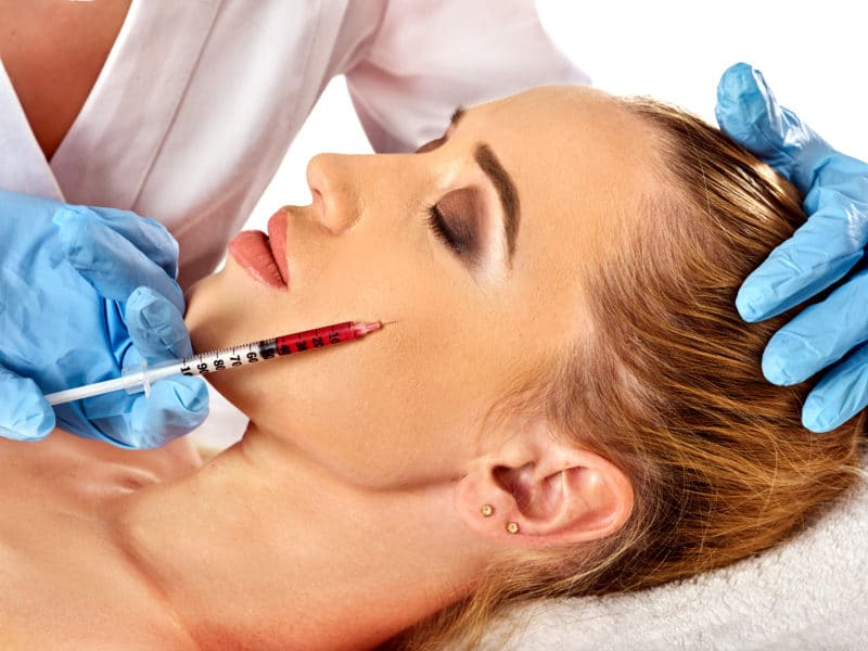 dermal fillers torrance