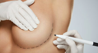 Implants vs. Fat Transfer: Which Breast Augmentation Technique Is Right for You?