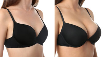Finding the Perfect Surgeon for Your Breast Augmentation: Questions to Ask
